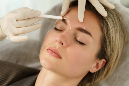 Is Botox Right for You