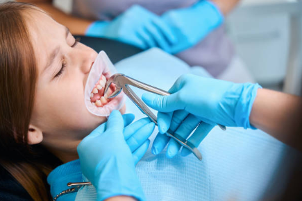 tooth extraction