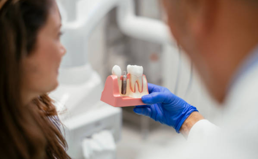 Dental Implants