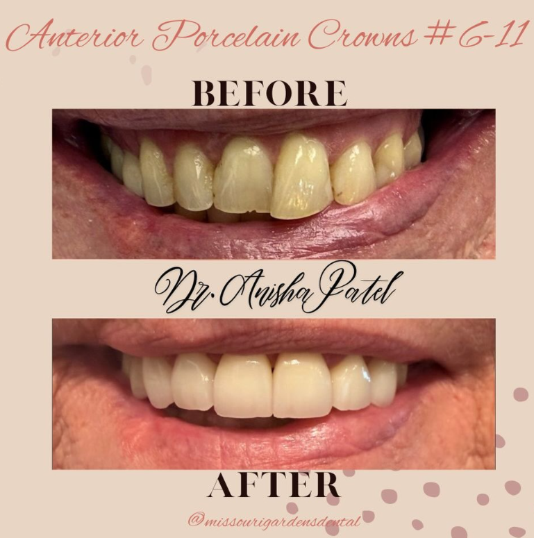 Why Choose Missouri Gardens Dental?